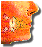 Gömülü 20'lik Diş Çekimi Fiyatları