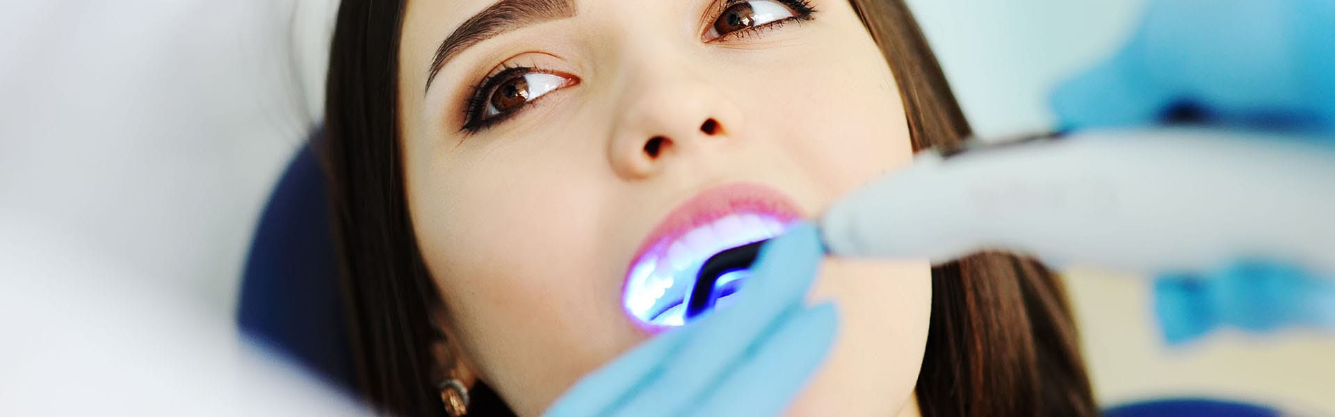 diş dolgu fiyatları